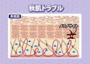 秋肌トラブル 断面図