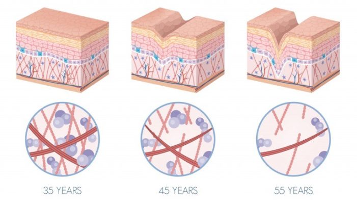 肌老化イメージ