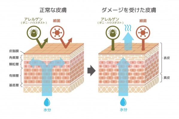 皮脂膜によるバリア機能