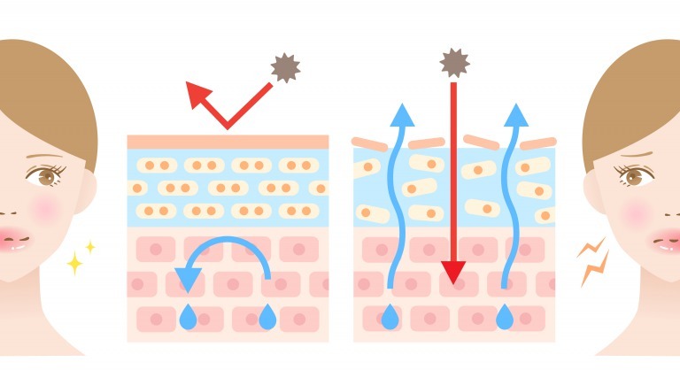 バリア機能が低下した肌の図