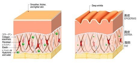 老化によるシワができる肌構造