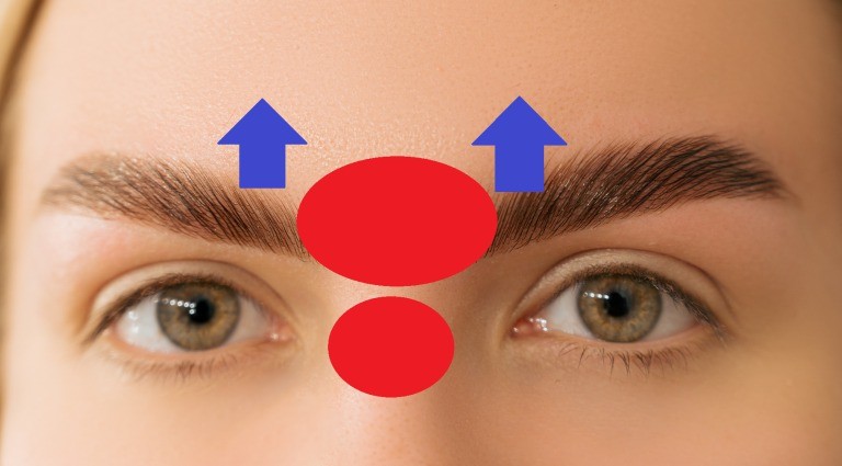 眉間のシワ改善方法