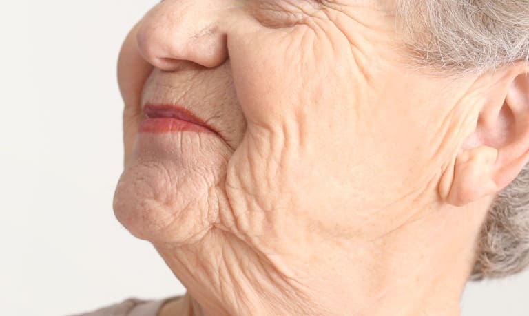 光老化による高齢者の顔のシワイメージ