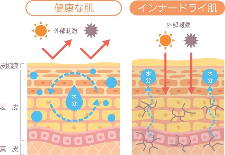 健康な肌とインナードライ肌