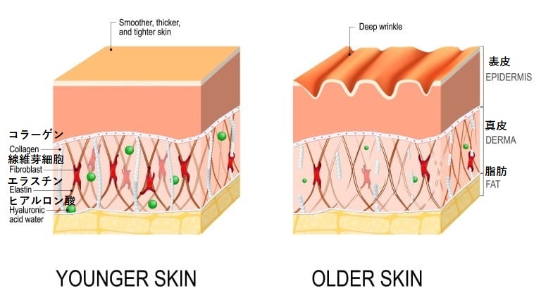 真皮のコラーゲンやエラスチン、ヒアルロン酸とシワの関係